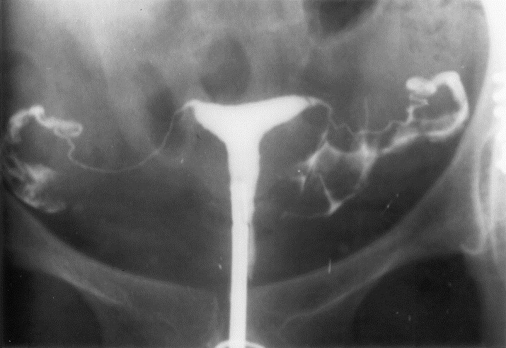 LM Diagnostic