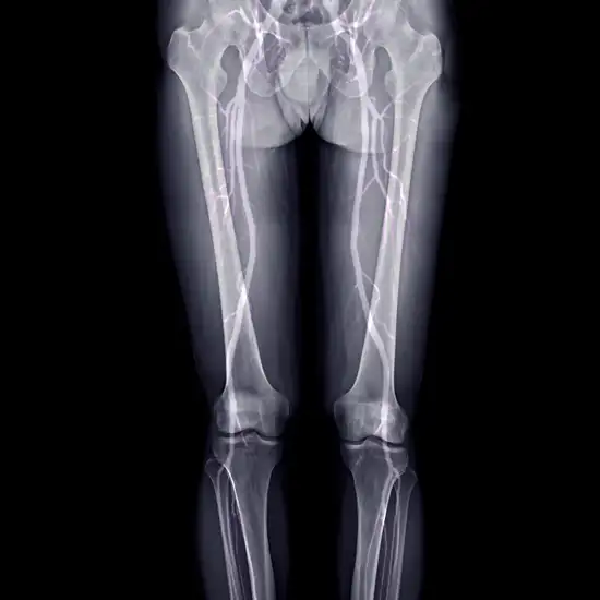 LM Diagnostic